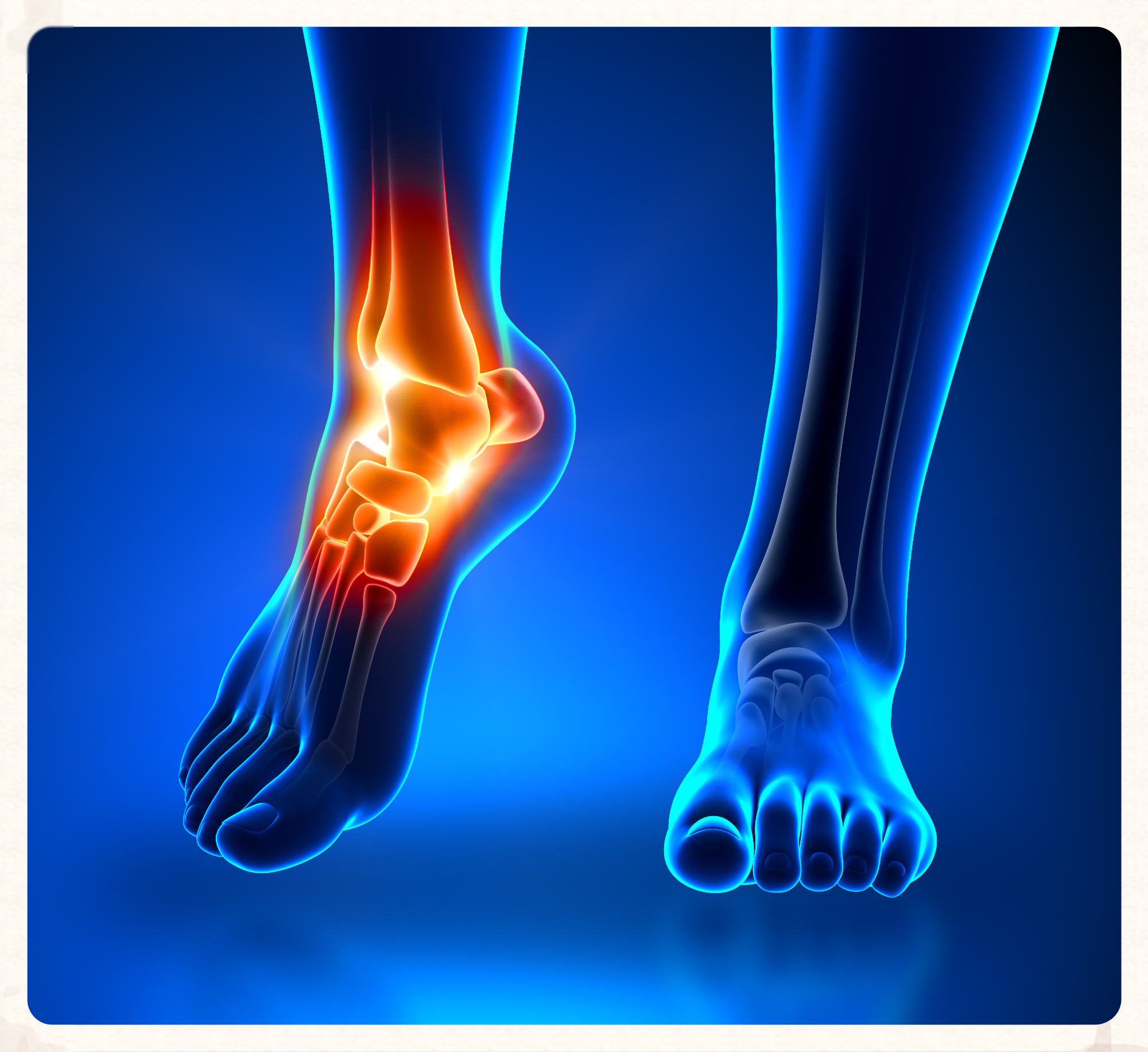 Ankle - Inmotion Orthotics